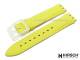 Watch band \