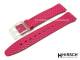 Watch band \