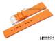 Watch band \