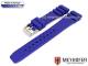 Watch band \