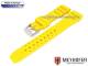 Watch band \