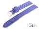 Watch band \