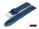  Watch band \