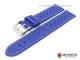 Watch band \