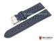 Watch band \