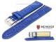 Watch band \