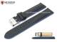 Watch band \