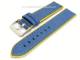Watch band \
