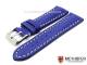 Watch band \