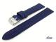 Watch band \