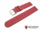 Watch band \
