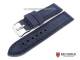 Watch band \