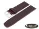 Watch band \