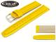 Watch band \