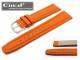 Watch band \