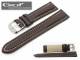 Watch band \