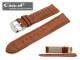 Watch band \