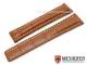 Watch band \