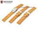 Watch band \
