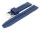 Watch band \